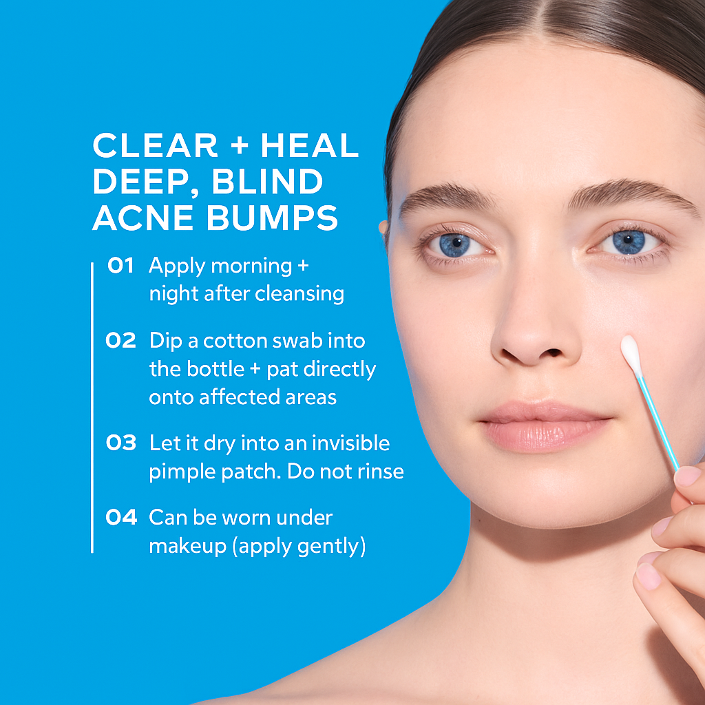 Delorien® Deep Relief Acne Treatment